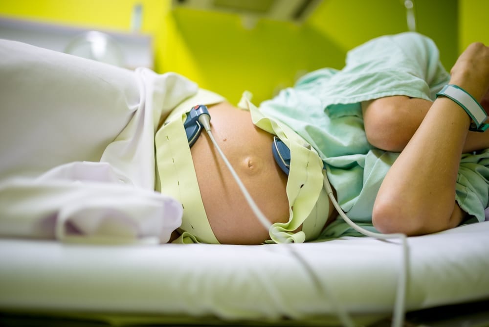 5 things you didn't know happens during an epidural #epidural #childbirth 