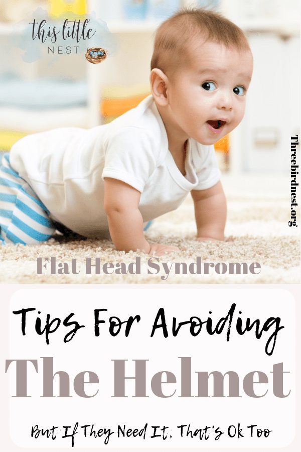 HOw to prevent flat head in babies, correction without a helmet #flathead #flatheadtreatment #flatheadsyndrome