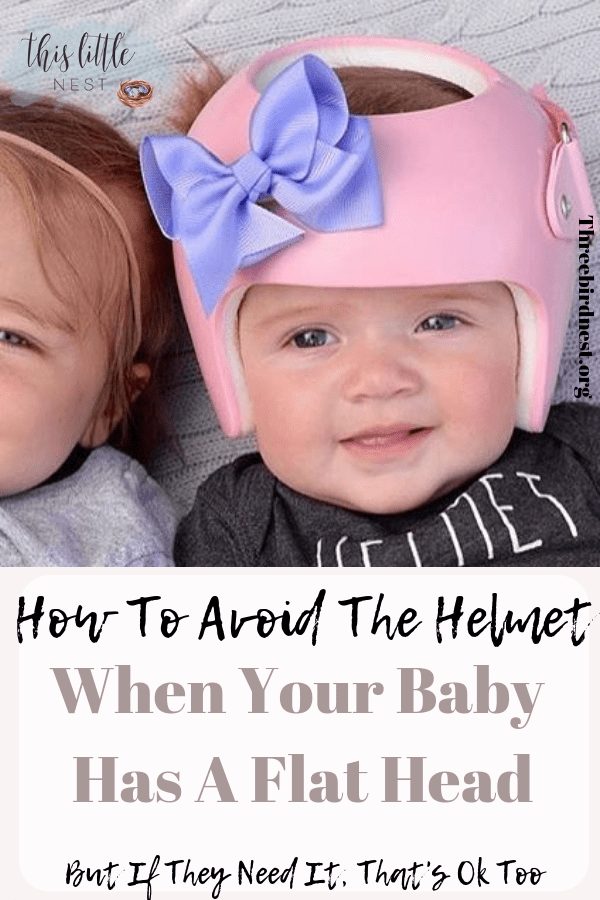 HOw to prevent flat head in babies, correction without a helmet #flathead #flatheadtreatment #flatheadsyndrome 