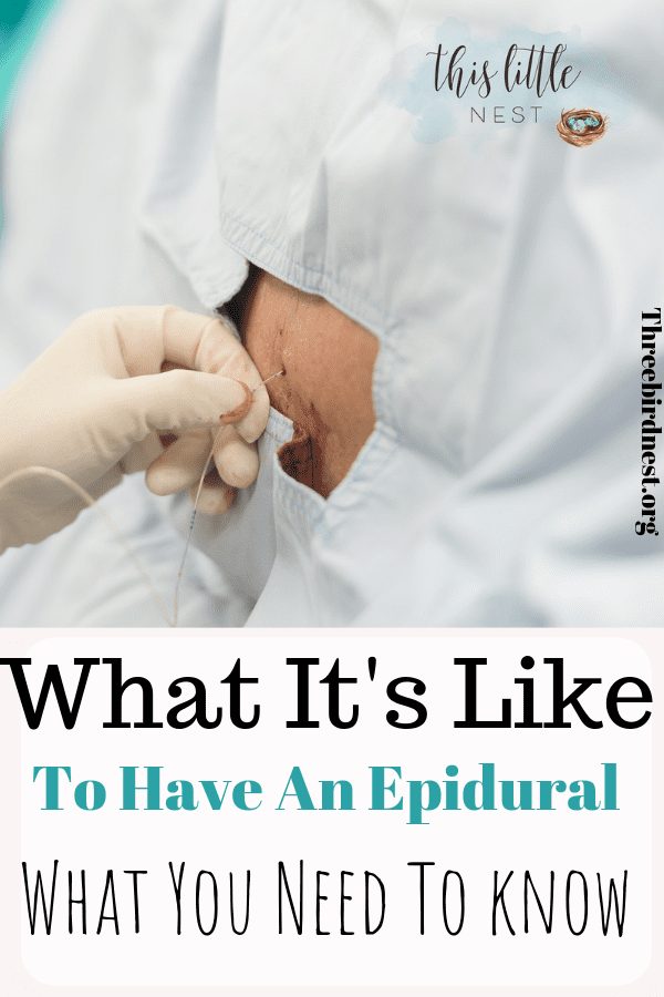 What it's like to Get An Epidural #Epidural #laborpainrelief #Epiduralsideeffects #childbirth #thirdtrimester